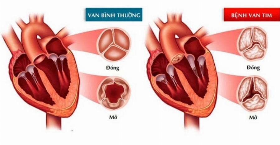 Diễn viên Hổ Vằn qua các thời kỳ