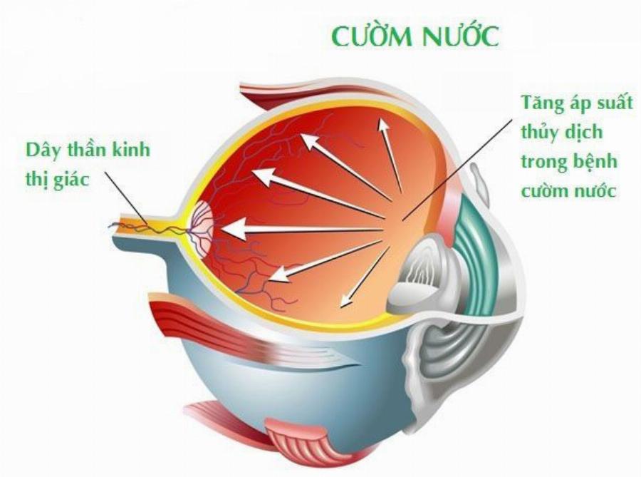 Thúy Loan trong một vai diễn nổi tiếng, thể hiện khả năng diễn xuất xuất thần.